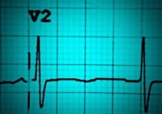 ECG Workshop: speed machine