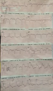 ECG 8