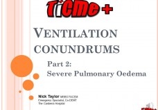 TiCME+ Difficult Ventilation Part 2: Severe Pulmonary Oedema