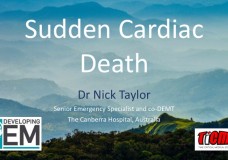 Sudden Cardiac Death