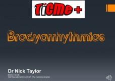 TiCME+ Bradyarrhythmias