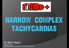 TiCME+ Narrow Complex Tachycardias