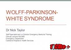 Wolff Parkinson White Syndrome